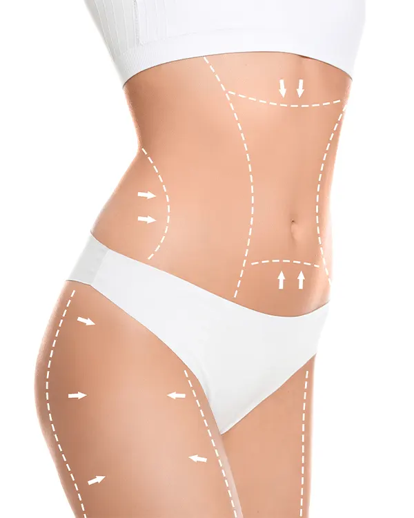 Img-Dra_Yolanda_Parales-Procedimiento-Lipoescultura