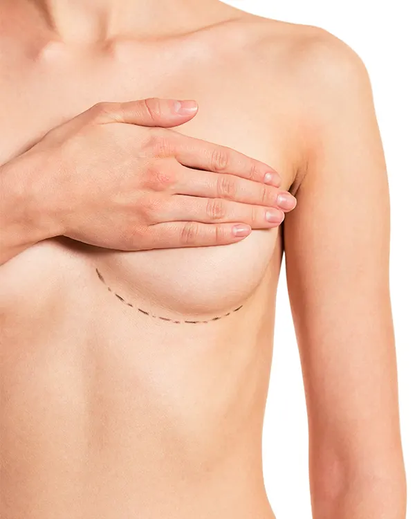 Img-Dra_Yolanda_Parales-Procedimiento-Mamoplastia de reduccion