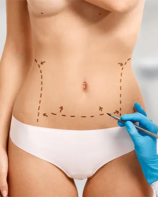 img-abdominoplastia-en-bogota-1-LCP